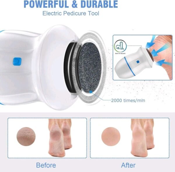 Electric Foot Callus - Image 4